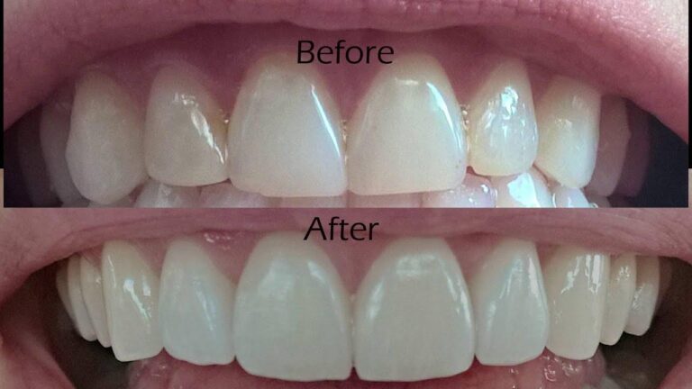 Choosing a Dental Clinic for Cosmetic Procedures